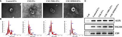 Naringenin suppresses BEAS-2B-derived extracellular vesicular cargoes disorder caused by cigarette smoke extract thereby inhibiting M1 macrophage polarization